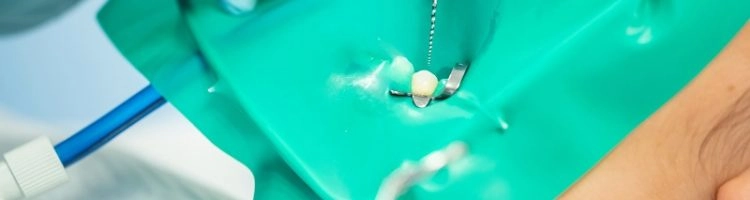 leczenie kanałów zębowych